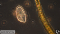 Pleuronema coronatum