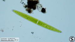 Closterium acerosum
