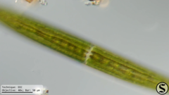 Closterium acerosum