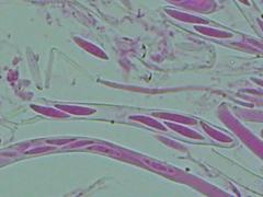 Mitrula lunulatospora