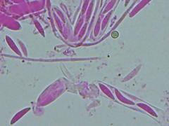 Mitrula lunulatospora