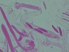 Mitrula lunulatospora