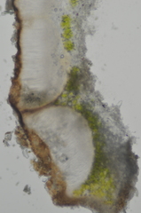 Acarospora nodulosa