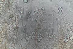 Pulvinula tetraspora