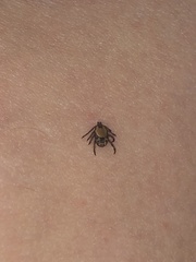 Rhipicephalus pulchellus