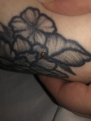 Rhipicephalus pulchellus