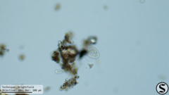 Pleuronema coronatum