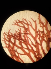Sphaerococcus coronopifolius