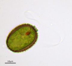 Trachelomonas hispida