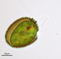 Trachelomonas hispida