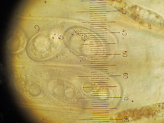 Adelphella babingtonii
