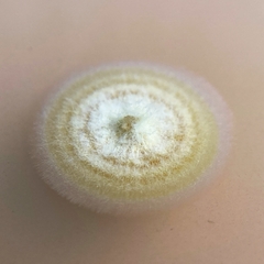 Pseudogymnoascus appendiculatus