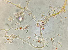 Pseudogymnoascus appendiculatus