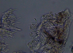 Scoliciosporum sarothamni