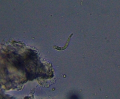Scoliciosporum sarothamni
