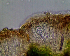 Scoliciosporum sarothamni