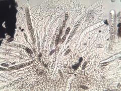 Hysterium angustatum