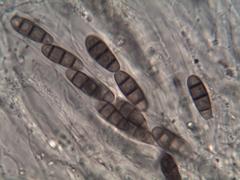 Hysterium angustatum