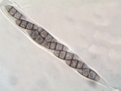 Hysterium angustatum