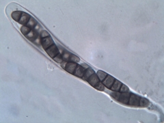 Hysterium angustatum