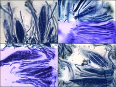 Collema subnigrescens