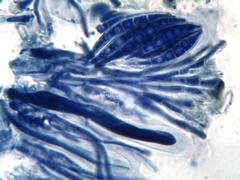 Collema subnigrescens