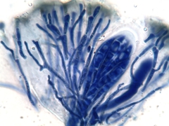 Collema subnigrescens