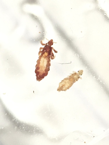 Head louse