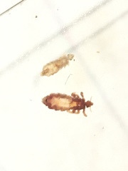 Pediculus humanus capitis