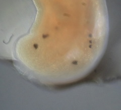 Prostoma