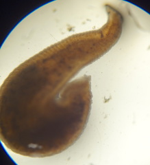Hirudinea