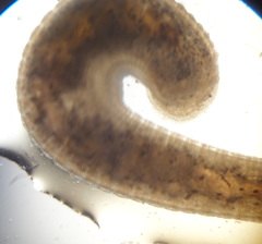 Hirudinea