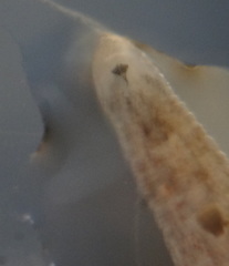 Hirudinea