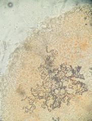 Bionectriaceae