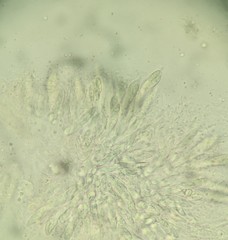 Bionectriaceae