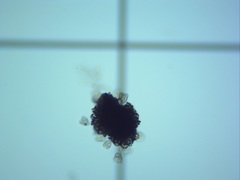 Dolichospermum