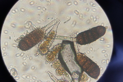 Phragmidium bulbosum