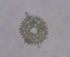 Pediastrum duplex