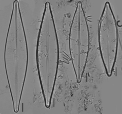 Craticula acidoclinata
