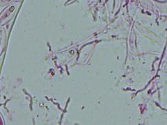 Propolis farinosa