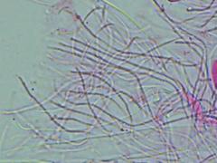 Propolis farinosa