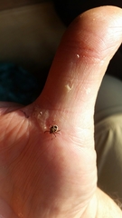 Rhipicephalus pulchellus