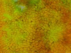 Puccinia arenariae