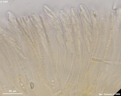 Hymenoscyphus menthae