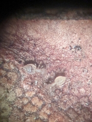 Trichopsocus