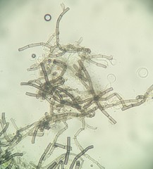 Helicomyces