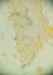 Puccinia cymbiformis