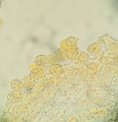 Puccinia cymbiformis