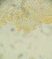 Puccinia cymbiformis