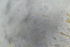 Cheilymenia coprinaria